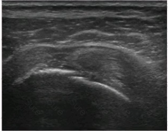 RhMSUS Question 8